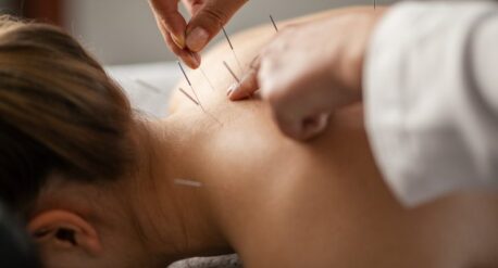 Seeking drug addiction treatment in Boston, Massachusetts (MA)? Learn how Acupuncture Therapy at Seabrook can aid in your recovery journey.